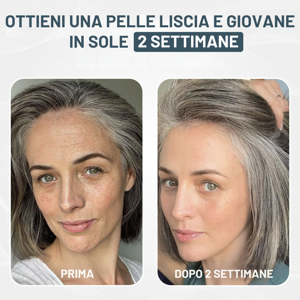 Kit Micro-Infusione Miaxa™ Soluzione Anti-Età
